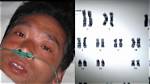83 Days of Hisashi Ouchi's Suffering Revealed