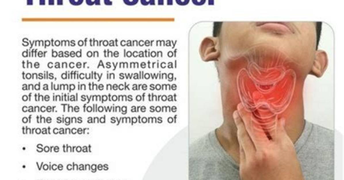 A Comprehensive Guide to Throat Cancer Awareness