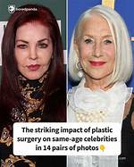 Age, Legacy, and Impact on Plastic Surgery