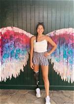 Alaqua Cox's Leg Injury: an Inspiring Story of Resilience
