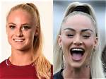 Alisha Lehmann's Plastic Surgery: 2024 Predictions & Impact