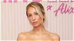 Alix Earle Seems to Be Open About Her Plastic Surgery but Is She Really?