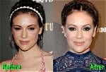 Alyssa Milano Plastic Surgery Before and After
