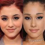Ariana Grande's Eye Surgery and Its Profound Implications