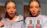 Barbie Botox: the Beauty Trend Taking the World by Storm