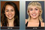 Before & After Photos Hollywood Life ·