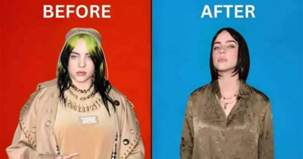 Billie Eilish Breast Reduction: a Journey Towards Self-Acceptance