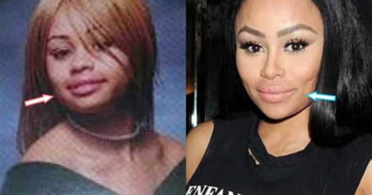 Blac Chyna Before Plastic Surgery: Uncovering Hidden Truths