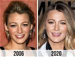 Blake Lively Plastic Surgery: a Transformation from Girl Next Door to Hollywood Bombshell
