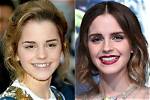 Celebrity Teeth Before & After: Dental Whitening Makeovers