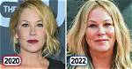 Christina Applegate Faces off with a Troll Who Says Her Face Was Ruined by Plastic Surgery, Not Ms