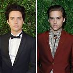 Cole Sprouse Teeth Before and After -Has He Used Braces and Whitened Them?
