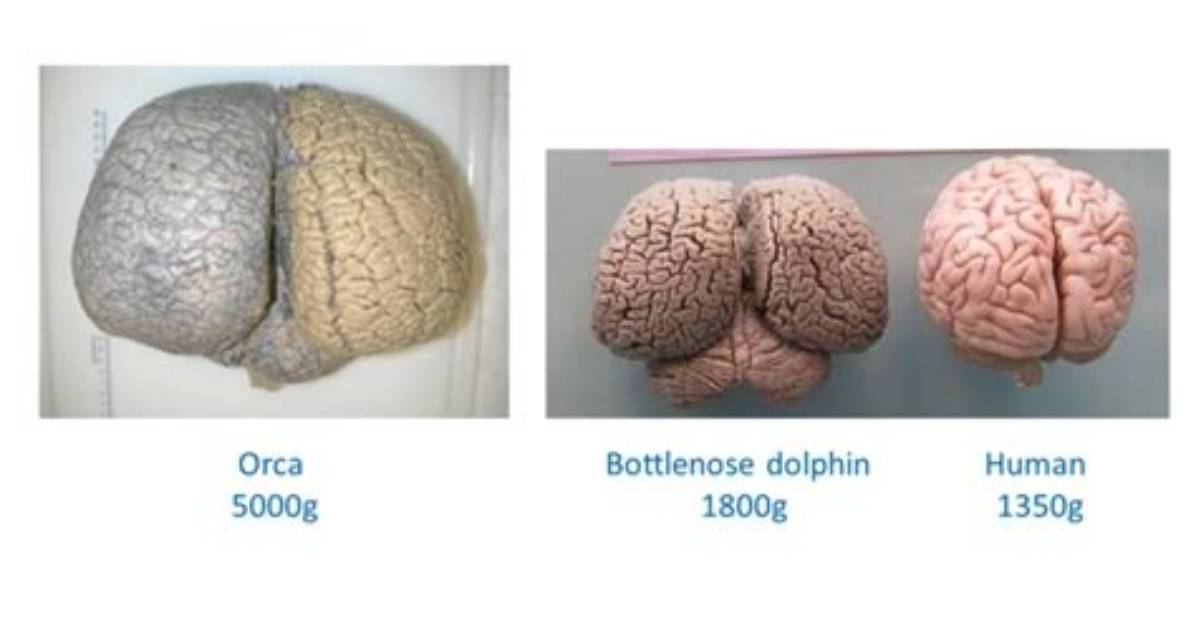 Comparing an Orca's Brain to a Human's Explains Why Killer Whales Are the Ocean's Ultimate Apex Pred