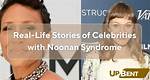 Courage and Resilience: Celebrities with Noonan Syndrome
