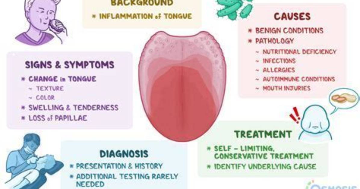Definitive Guide to Drummond Diagnosis: Symptoms, Causes, and Treatment