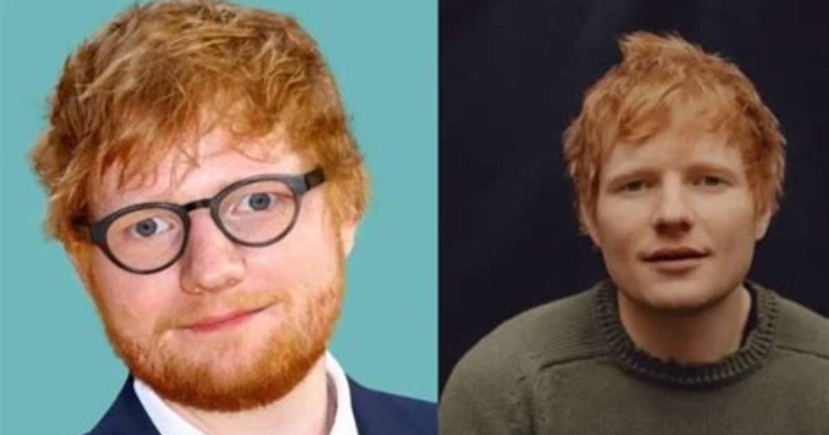 Despite Being Speculated to Have Undergone Plastic Surgery, Ed Sheeran Said That He Would Never Choo