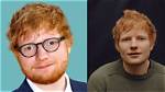 Despite Being Speculated to Have Undergone Plastic Surgery, Ed Sheeran Said That He Would Never Choo