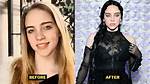 Did Billie Eilish Get a Boob Job?