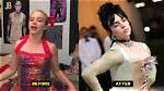 Did Billie Eilish Have Breast Reduction? Exploring the Truth Behind the Rumors