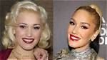 Did Gwen Stefani Get Lips Surgery? Before and After Photos