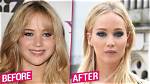 Did Jennifer Lawrence Have Plastic Surgery? |