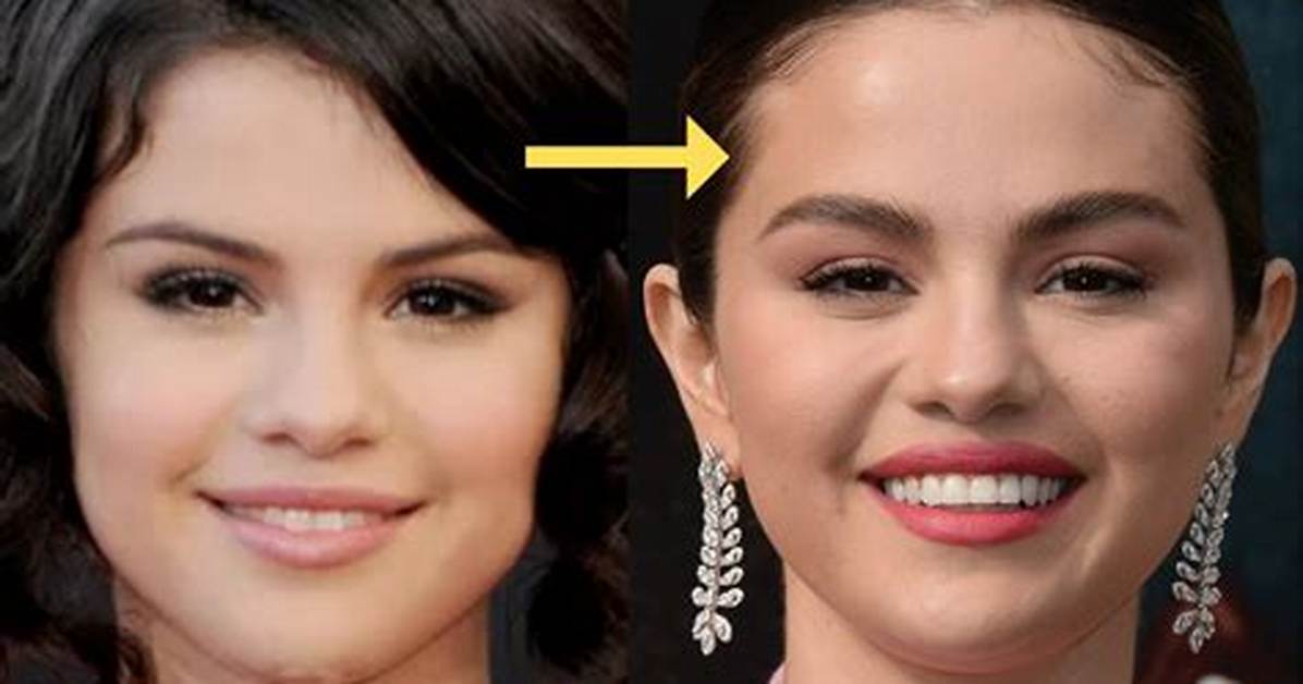 Did Selena Gomez Get Plastic Surgery? Exploring the Evidence and Rumors