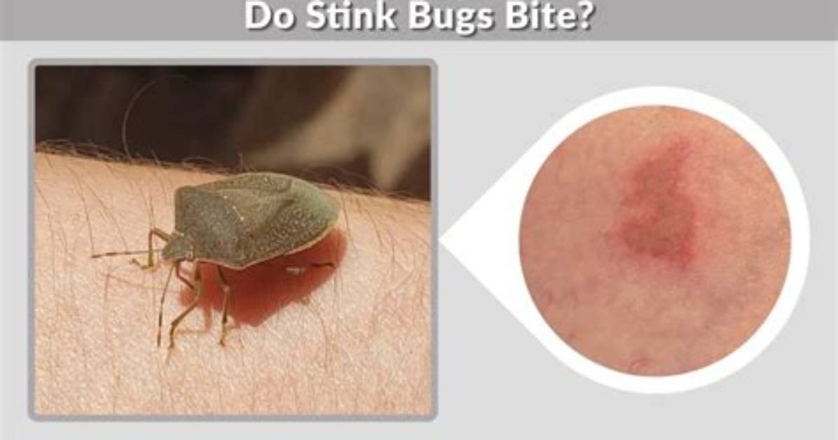 Do Grain Bugs Bite? |