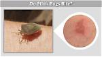 Do Grain Bugs Bite? |
