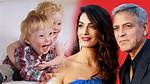 Does George Clooney's Twins Have Down Syndrome? Here's the Truth