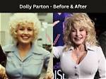 Dolly Parton's Breasts Real or Fabricated?