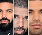 Drake Nose Surgery: Everything You Need to Know