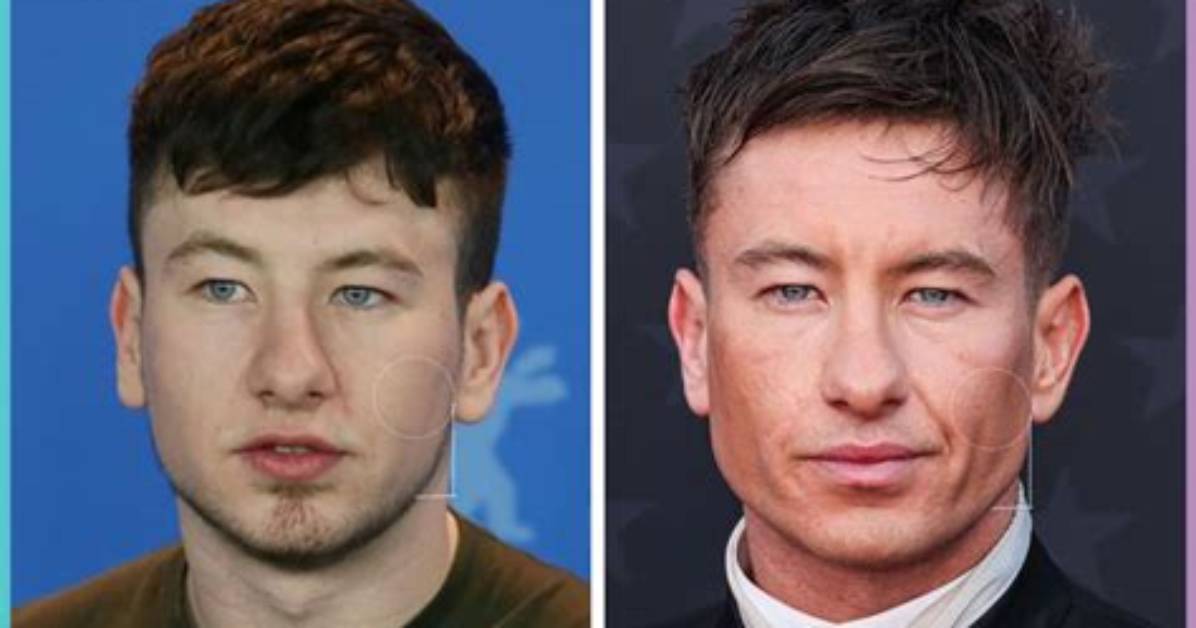 Examining Barry Keoghans Alleged Plastic Surgery! ·