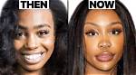 Exploring the Truth: Has Tyla Had Plastic Surgery?