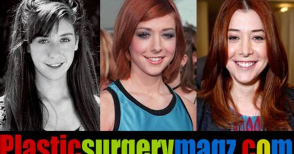 Fans’ Focus on Alyson Hannigan’s Plastic Surgery and Breast Implants! Do the Rumors About Alyson Hannigan’s Plastic Surgery Exist?