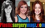 Fans’ Focus on Alyson Hannigan’s Plastic Surgery and Breast Implants! Do the Rumors About Alyson Hannigan’s Plastic Surgery Exist?