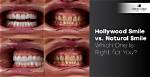 From Natural Smile to Hollywood Glam