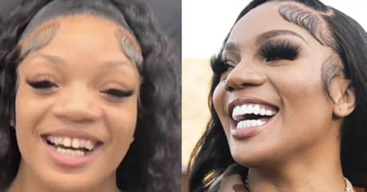 Glorilla Before and After: Bbl and New Teeth