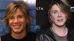 Goo Goo Dolls Frontman Plastic Surgery Before and After