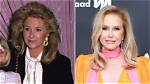 Has Rhobh Kathy Hilton Done Plastic Surgery? Fans Suspect Botox and Nose Job ·