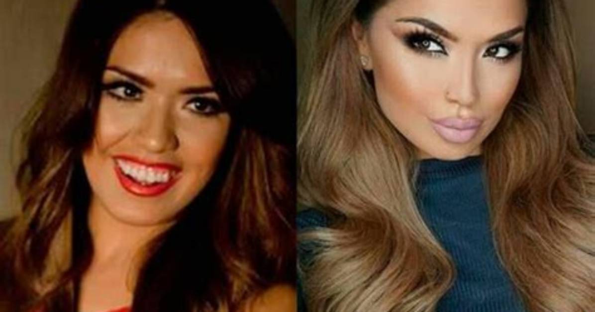 Iluvsarahii Before and After Bbl