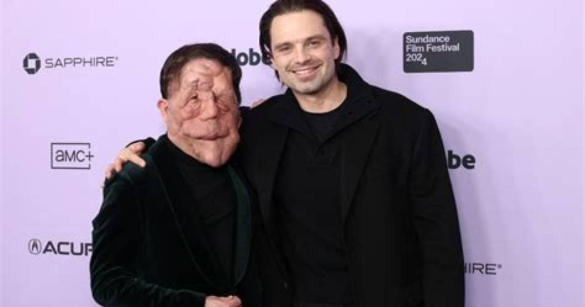 Is Adam Pearson Married? Unveiling the Personal Life of the Inspiring Advocate