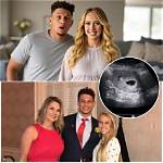 Is Brittany Mahomes Pregnant? the Truth Behind the Wife of Chiefs Star Patrick Mahomes ·