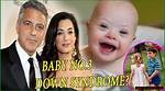 Is Down Syndrome Affecting George Clooney's Twins? - Full Investigation