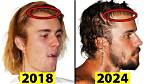 Is Justin Bieber Aging Too Fast? the Surprising Transformation
