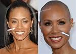 Jada Pinkett Smith's Nose Job: Before and After Photos