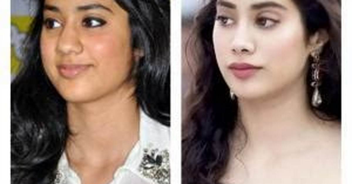 Janhvi Kapoor's Plastic Surgery Journey
