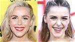 Kiernan Shipka Veneers: Teeth Before and After Photos