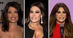 Kimberly Guilfoyle's Transformation: Before and After Surgery