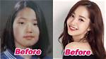 Korean Plastic Surgery Celebrity: the Transformative Journey of Beauty