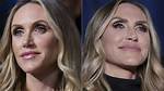 Lara Trump Plastic Surgery Before and After Transformation: the Full Story You Need to Know